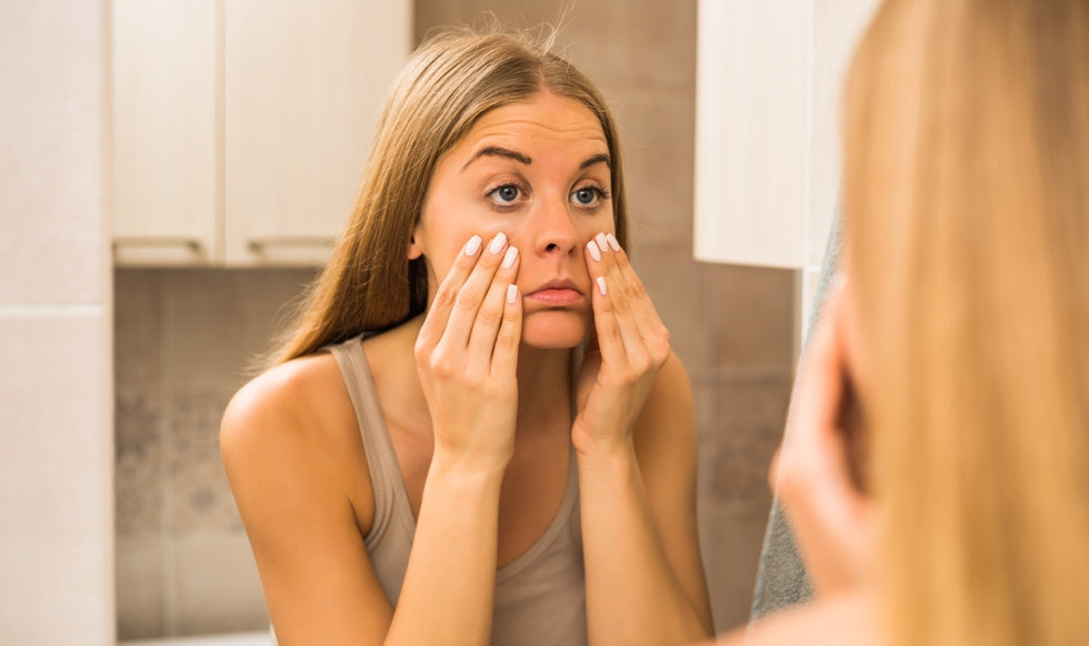 How To Banish Dark Circles